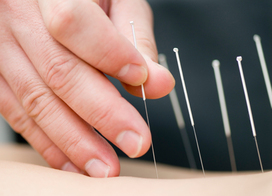 Acupuncture Back